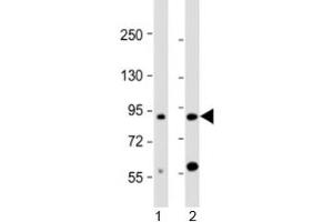 Western blot testing of human 1) brain and 2) HL-60 cell lysate with CCDC144A antibody at 1:2000. (CCDC144A Antikörper  (AA 1257-1289))