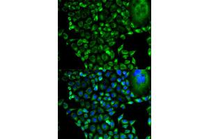 Immunofluorescence (IF) image for anti-Proteasome (Prosome, Macropain) 26S Subunit, Non-ATPase, 10 (PSMD10) antibody (ABIN1874388) (PSMD10 Antikörper)