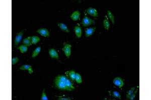 Immunofluorescent analysis of A549 cells using ABIN7175212 at dilution of 1:100 and Alexa Fluor 488-congugated AffiniPure Goat Anti-Rabbit IgG(H+L) (ATP6VA1 (AA 80-260), (Isoform 1) Antikörper)