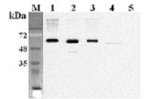 Western blot analysis using anti-FTO (human), mAb (FT86-4)  at 1:2'000 dilution. (FTO Antikörper)