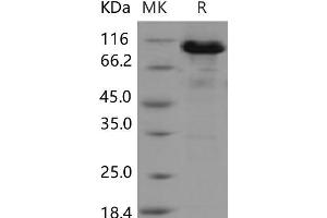 Western Blotting (WB) image for Aconitase 2, Mitochondrial (ACO2) protein (GST tag,His tag) (ABIN7320070)