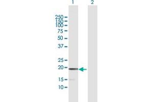 Western Blot analysis of MCEE expression in transfected 293T cell line by MCEE MaxPab polyclonal antibody. (MCEE Antikörper  (AA 1-176))