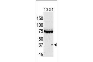 Antibody is used in Western blot to detect Aurora C in lysates of 293 cells expressing Flag tag (lane 1), Flag-tagged Aurora A (lane 2), Flag-tagged Aurora B (lane 3), and Flag-tagged Aurora C (lane 4). (Aurora Kinase C Antikörper  (AA 115-145))
