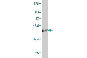 Western Blot detection against Immunogen (36. (Acox2 Antikörper  (AA 582-681))
