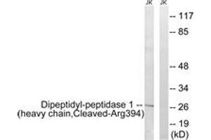 Western Blotting (WB) image for anti-Cathepsin C (CTSC) (AA 345-394), (Cleaved-Arg394) antibody (ABIN2891193) (CTSC Antikörper  (Cleaved-Arg394))