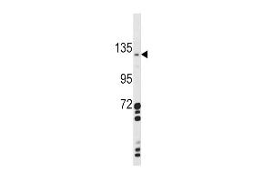 Western blot analysis of CLEC16A Antibody in A2058 cell line lysates (35ug/lane) (CLEC16A Antikörper  (AA 365-391))