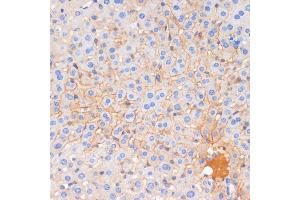 Immunohistochemistry of paraffin-embedded mouse liver using E-Cadherin antibody  at dilution of 1:100 (40x lens). (E-cadherin Antikörper)
