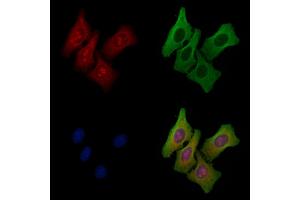 ABIN6258293 and ABIN6275329 staining Hela cells by IF/ICC. (NOLC1 Antikörper  (C-Term))