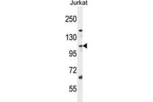 Western blot analysis in Jurkat cell line lysates (35ug/lane) using Sorting nexin-25 (SNX25)  Antibody .