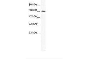 Image no. 1 for anti-Iroquois Homeobox Protein 1 (IRX1) (AA 123-172) antibody (ABIN202627) (IRX1 Antikörper  (AA 123-172))