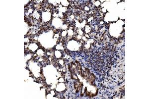 IHC analysis of delta 1 Catenin/CAS/CTNND1 using anti-delta 1 Catenin/CAS/CTNND1 antibody (ABIN7602221). (CTNND1 Antikörper  (AA 64-930))