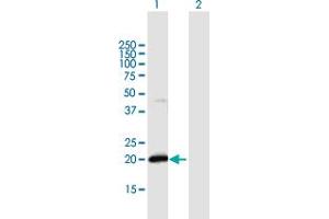 Western Blot analysis of IFNA21 expression in transfected 293T cell line by IFNA21 MaxPab polyclonal antibody. (IFNA21 Antikörper  (AA 1-189))
