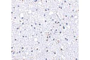 Immunohistochemistry of DARC in human brain tissue with DARC antibody at 5 μg/ml. (DARC Antikörper  (N-Term))