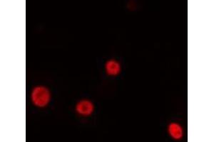 ABIN6275195 staining HeLa cells by IF/ICC. (NK2 Homeobox 4 Antikörper  (Internal Region))