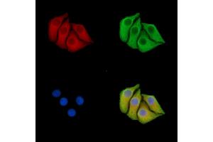 ABIN7096416 and ABIN7100480 staining Hela cells by IF/ICC. (FBXL2 Antikörper)