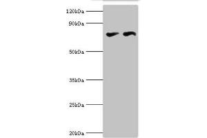 Western blot All lanes: Transcriptional repressor CTCF antibody at 6 μg/mL Lane 1: PC-3 whole cell lysate Lane 2: MCF-7 whole cell lysate Secondary Goat polyclonal to rabbit IgG at 1/10000 dilution Predicted band size: 83, 46 kDa Observed band size: 83 kDa (CTCF Antikörper  (AA 1-260))