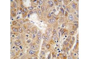 Immunohistochemistry (IHC) image for anti-Phosphoglycerate Kinase 1 (PGK1) (AA 117-145) antibody (ABIN3032224)