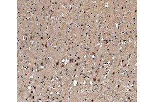 IHC analysis of Serum Response Factor/SRF using anti-Serum Response Factor/SRF antibody (ABIN7600144). (SRF Antikörper  (AA 154-508))