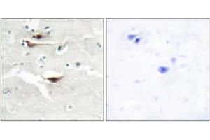 Immunohistochemistry (IHC) image for anti-Inositol 1,3,4,5,6-Pentakisphosphate 2-Kinase (IPPK) (AA 11-60) antibody (ABIN2889764) (IPPK Antikörper  (AA 11-60))