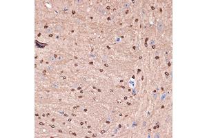 Immunohistochemistry of paraffin-embedded mouse brain using Carbonic Anhydrase 2 (C) Rabbit mAb (ABIN7266070) at dilution of 1:100 (40x lens). (CA2 Antikörper)