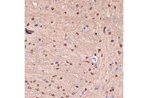 Immunohistochemistry of paraffin-embedded mouse brain using Carbonic Anhydrase 2 (C) Rabbit mAb (ABIN7266070) at dilution of 1:100 (40x lens).