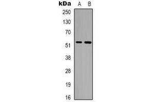 Western blot analysis of Alpha-tubulin (AcK352) expression in A549 (A), Jurkat (B) whole cell lysates. (alpha Tubulin Antikörper  (acLys352))