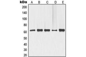 Western blot analysis of p63 expression in COLO205 (A), ME180 (B), HeLa (C), LOVO (D), HT29 (E) whole cell lysates. (TCP1 alpha/CCTA Antikörper  (N-Term))