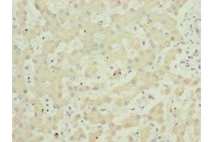 Immunohistochemistry of paraffin-embedded human liver tissue using ABIN7173949 at dilution of 1:100 (TWIST2 Antikörper  (AA 1-70))