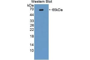 WB of Protein Standard: different control antibodies against Highly purified E. (ATG16L1 ELISA Kit)