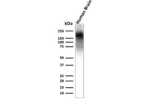 Western Blot Analysis of human brain lysate using Neurofilament Rabbit Recombinant Monoclonal Ab (NEFL. (Rekombinanter NEFH Antikörper)