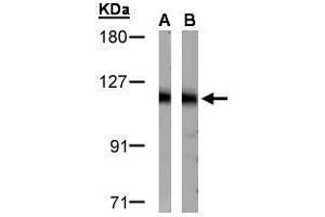 WB Image Sample(30 μg of whole cell lysate) A:HeLa S3 , B:Raji, 7. (DDB1 Antikörper)