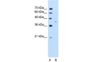 Western Blotting (WB) image for anti-GNAS Complex Locus (GNAS) (C-Term) antibody (ABIN2776982)