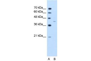 WB Suggested Anti-GNAS  Antibody Titration: 2. (GNAS Antikörper  (C-Term))