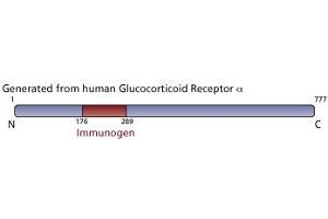Image no. 3 for anti-Nuclear Receptor Subfamily 3, Group C, Member 1 (Glucocorticoid Receptor) (NR3C1) (AA 176-289) antibody (ABIN968431) (Glucocorticoid Receptor Antikörper  (AA 176-289))