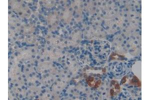 Used in DAB staining on fromalin fixed paraffin- embedded kidney tissue (CSTA Antikörper  (AA 1-103))