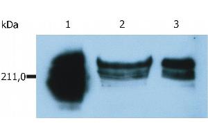 Western Blotting analysis of whole cell lysate of HUT-78 human cutaneous T cell lymphoma cell line. (CD45RA Antikörper  (APC))