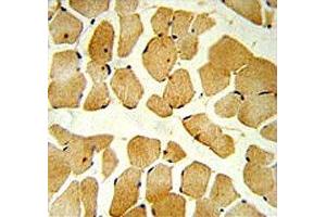 SPHK1 antibody IHC analysis in formalin fixed and paraffin embedded skeletal muscle.