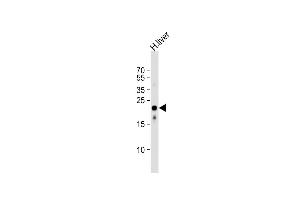 Western Blotting (WB) image for anti-Methylmalonic Aciduria (Cobalamin Deficiency) CblB Type (MMAB) (AA 50-81) antibody (ABIN1944767)