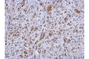 Immunohistochemistry (IHC) image for anti-Methylmalonic Aciduria (Cobalamin Deficiency) CblC Type, with Homocystinuria (MMACHC) (Center) antibody (ABIN2856443)