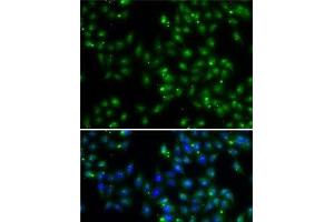 Immunofluorescence analysis of A-549 cells using DUSP22 Polyclonal Antibody (DUSP22 Antikörper)