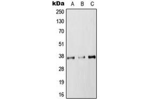 Western blot analysis of RAB36 expression in HEK293T (A), NIH3T3 (B), PC12 (C) whole cell lysates. (RAB36 Antikörper  (Center))
