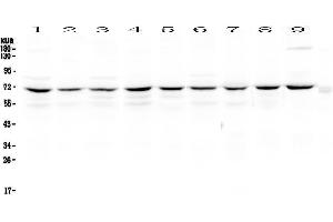Western blot analysis of cIAP1 using anti-cIAP1 antibody . (BIRC2 Antikörper  (AA 320-570))