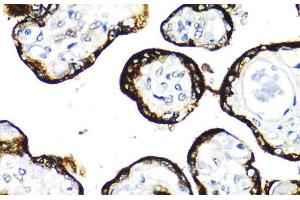 Immunohistochemistry of paraffin-embedded Human placenta using FGFR2 Polyclonal Antibody at dilution of 1:100 (40x lens). (FGFR2 Antikörper)