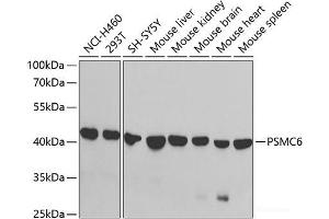 Western blot analysis of extracts of various cell lines using PSMC6 Polyclonal Antibody at dilution of 1:1000. (PSMC6 Antikörper)