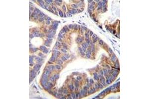 Immunohistochemistry (Paraffin-embedded Sections) (IHC (p)) image for anti-Family with Sequence Similarity 109, Member A (FAM109A) (AA 10-39), (N-Term) antibody (ABIN952171)