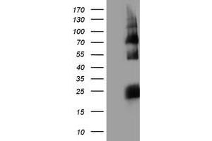 Western Blotting (WB) image for anti-Histidyl-tRNA Synthetase 2, Mitochondrial (Putative) (HARS2) antibody (ABIN1498585) (HARS2 Antikörper)