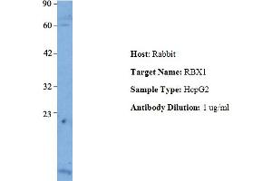 Host: Rabbit Target Name: RBX1 Sample Type: Human HepG2 Antibody Dilution: 1. (RBX1 Antikörper  (Middle Region))