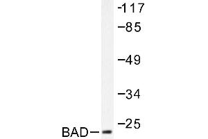 Image no. 1 for anti-BCL2-Associated Agonist of Cell Death (BAD) antibody (ABIN271900) (BAD Antikörper)