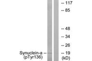 Western blot analysis of extracts from mouse brain, using Synuclein-alpha (Phospho-Tyr136) Antibody. (SNCA Antikörper  (pTyr136))