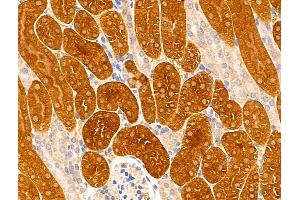 ABIN6261991 and ABIN6269006 at 1/100 staining Mouse kidney tissue by IHC-P. (Metabotropic Glutamate Receptor 6 Antikörper  (C-Term))